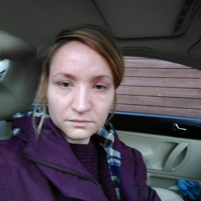 Women with rash on face from MCAS reaction, sat in a car