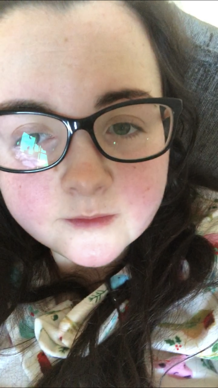 A red and swollen face, in the midst of an MCAS reaction